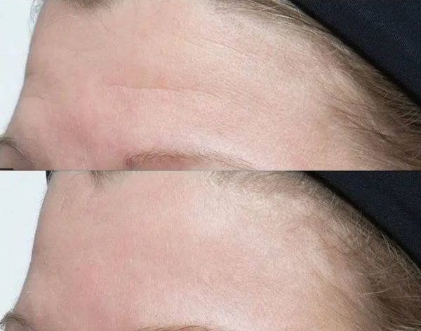 PERRICONE MD Neuropeptide Facial Cream - Imagen 4