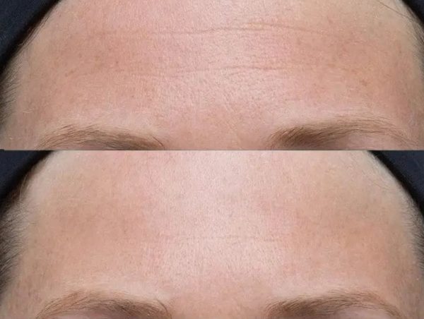 PERRICONE MD Neuropeptide Facial Cream - Imagen 3